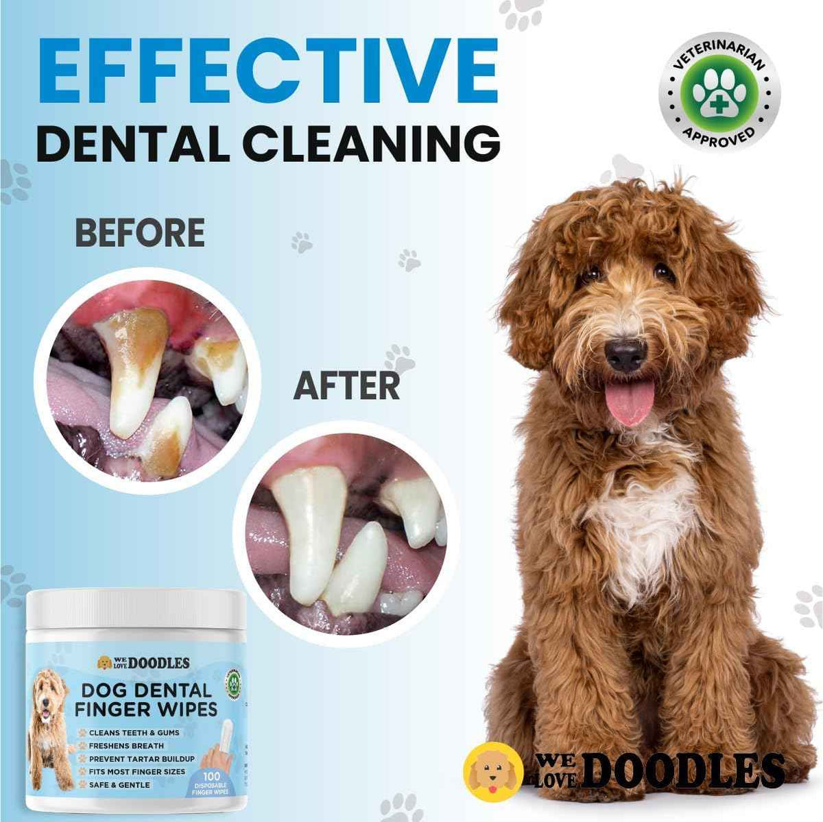 Dog Dental Finger Wipes (100 PCS)